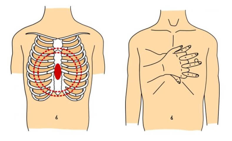 胸骨圧迫
